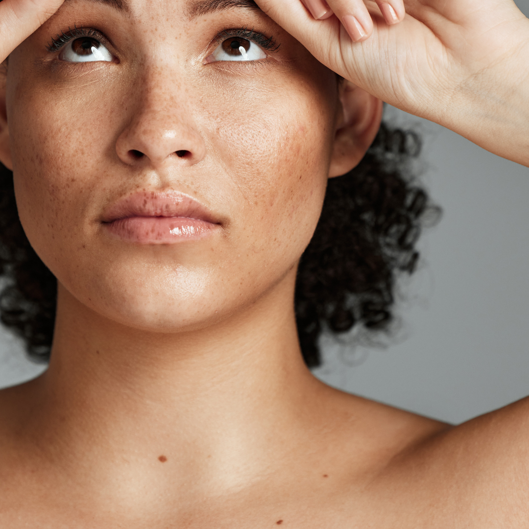 dehydrated-skin-jenni-and-co