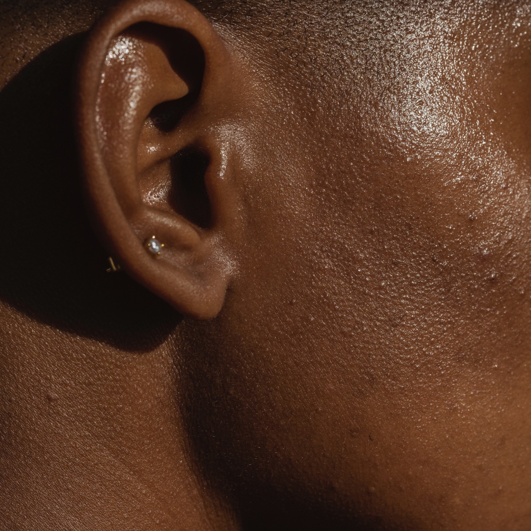 OILY SKIN