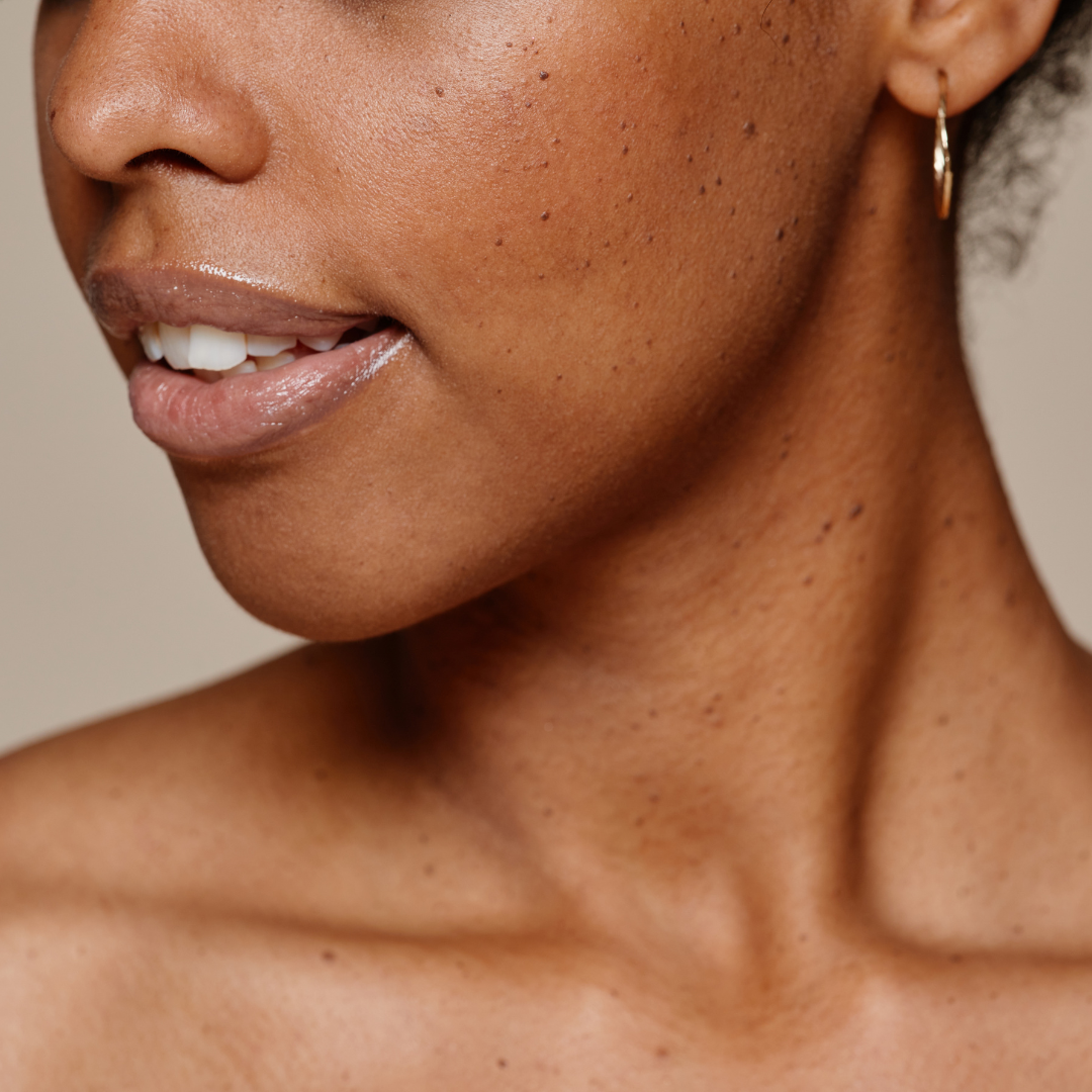 COMBINATION SKIN – Jenni and Co